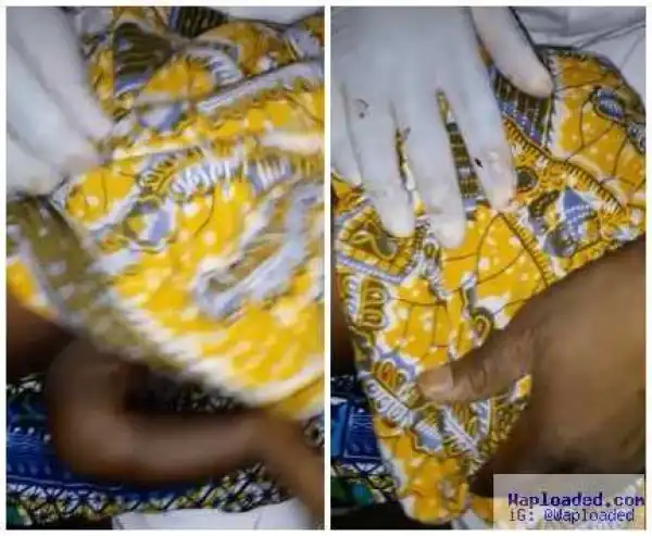 Woman Cuts Off Her Son’s Testicle In Minna, Niger State (Very Graphic Photos)